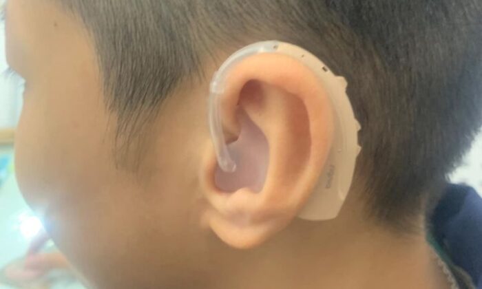 Nghe kém ở trẻ em: Máy trợ thính, đo khám tai và kiểm tra mức độ nghe kém tại Trung tâm Trợ thính Tâm An – Nam Định